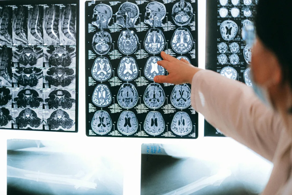 How AI Is Transforming Medical Diagnostics